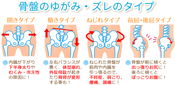 骨盤矯正 鎌倉市 深沢接骨院